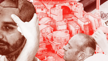 How JFSPlanner Became One Of The Best Hair Transplant Clinic?