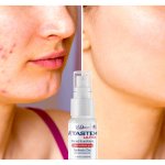 The Most Severe Types of Acne & How Vitastem Ultra Can Help Spray Away Bad Acne Fast
