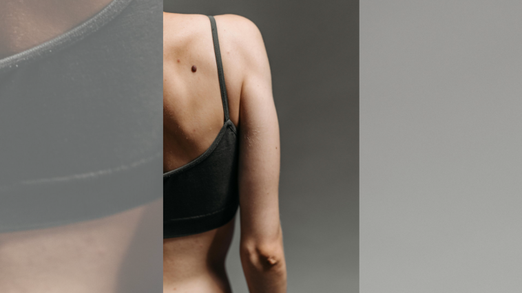 6 Potential Causes of Elbow Pain