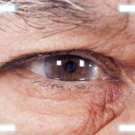 A Post-Op Guide to Cataract Surgery Recovery & Aftercare