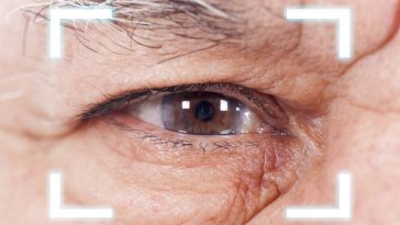 A Post-Op Guide to Cataract Surgery Recovery & Aftercare