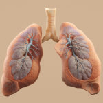 Diagnosed With Mesothelioma? Here's What You Can Do