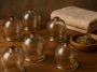 Traditional cupping therapy tools arranged in a wellness setting for healing in New York City